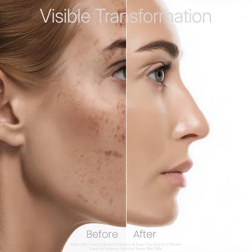 Vista 8 de A+B - Almohadillas faciales exfoliantes y reparadoras de 10 Tx, tratamiento de suero de cáscara ácida de 2 pasos con péptidos hialurónicos