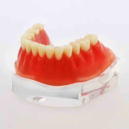Vista 2 de Dental Dientes Modelo Oro Plata Demostración Color Practise Enseñanza Demo 4 Implante (GOLD BAR)
