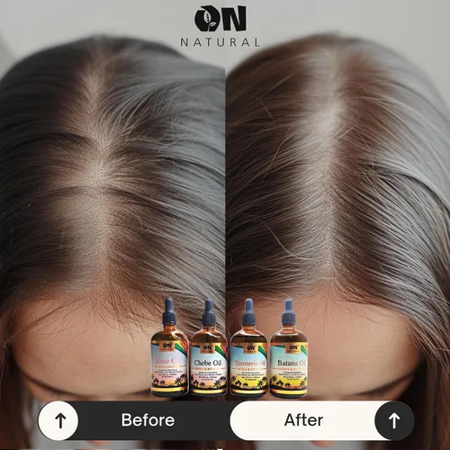 Vista 8 de On Natural Aceite de batana para mejorar el cabello y el cuero cabelludo