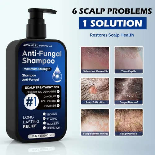 Vista 5 de Champú antifúngico para dermatitis seborreica, foliculitis y psoriasis del cuero cabelludo, champú anticaspa para hombres y mujeres, alivia