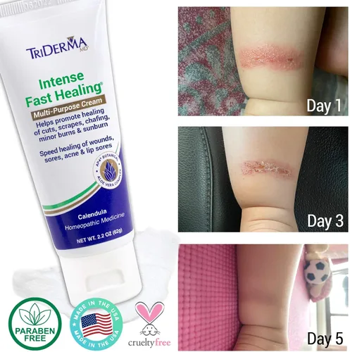 Vista 6 de TriDerma Crema multiusos intensa de curación rápida para cortes, rasguños, llagas, rozaduras, quemaduras menores y quemaduras solares