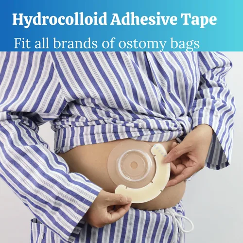 Vista 5 de 40 tiras de barrera para ostomía con huecos, suministros elásticos de urostomía de ileostomía, cintas extensoras de barrera cutánea para bolsas