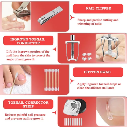 Vista 6 de Kit de eliminación de uñas encarnadas, tratamiento profesional de uñas encarnadas, kit de herramientas de uñas encarnadas con gotas correctoras