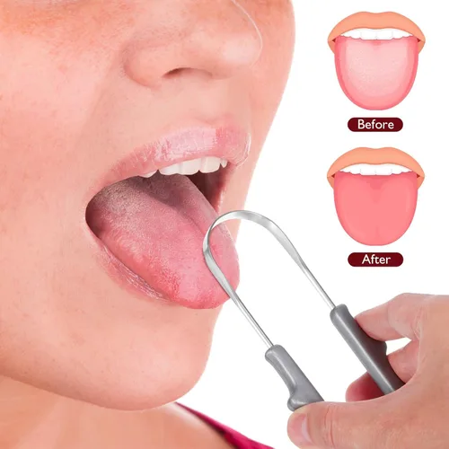 Vista 6 de Healifty Paquete de 4 raspadores de lengua con limpiador de lengua en forma de U, raspador de lengua de acero inoxidable para adultos, raspadores