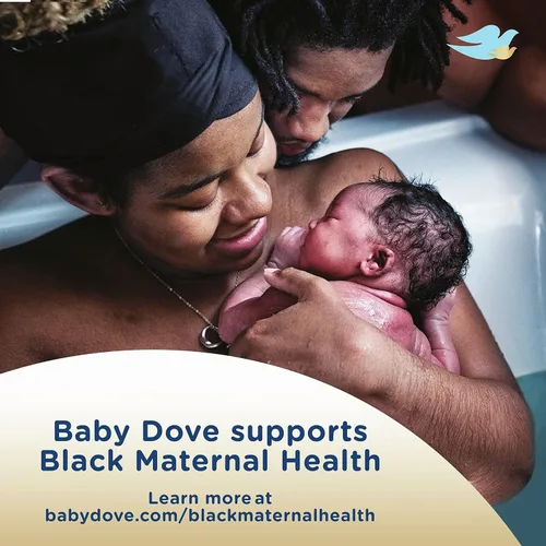 Vista 8 de Dove Jabón Corporal y Loción para Bebés con Cuidado de la Piel Rica en Melanina – Hipoalergénico, Apto para Recién Nacidos