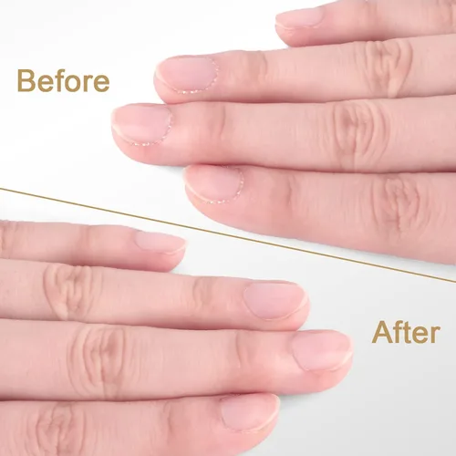 Vista 7 de Easkep - Corta cutículas y empujador de cutículas, corta cutículas profesional de acero inoxidable para dedos de manos y pies, pedicura y manicura
