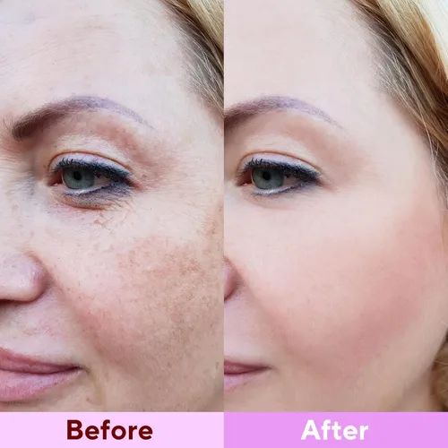 Vista 5 de Mascarilla profunda de bio-colágeno, paquete de 8 mascarillas hidratantes para todo tipo de piel, mascarilla facial hidratante original de colágeno
