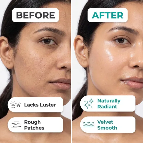 Vista 5 de Mambino Organics Fresh Glow - Exfoliante facial 3 en 1, limpiador facial exfoliante y limpiador facial para un cuidado suave de la piel, exfoliante