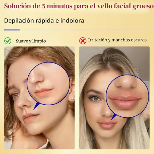 Vista 3 de Depilación facial de 5 minutos para mujeres, sin dolor y suave, crema de depilación de piel sensible con crema calmante para mentón, labio superior