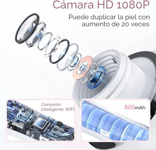 Vista 2 de Removedor de Puntos Negros al Vacío, Removedor de Cabezas Negras para la Cara con Cámara, Aspirador de Poros para Hombres y Mujeres, Herramientas