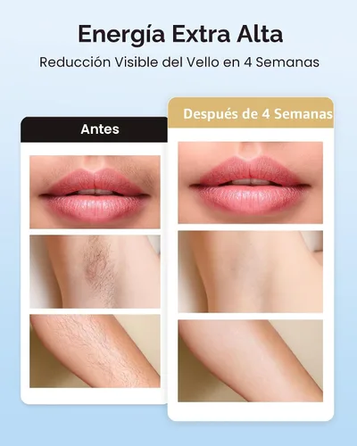 Vista 3 de INNZA Depilación láser con función de cuidado de enfriamiento por hielo para mujeres, permanente, 999,999 destellos sin dolor IPL, dispositivo