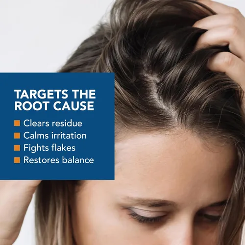 Vista 6 de Kenkoderm Acondicionador para cabello y piel sensibles con 3 por ciento de ácido salicílico, hidratante profundo anticaspa para alivio de picazón