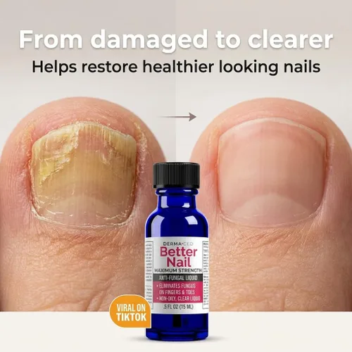 Vista 3 de Better Nail - Tratamiento para hongos debajo y alrededor de la uña - Fuerza máxima, solución antifúngica al 25% para el soporte de las uñas