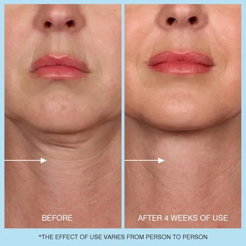 Vista 6 de UJhay Crema de Cuello con Retinol, Crema Reafirmante Enriquecida con Ácido Hialurónico y Cafeína para Minimizar Líneas Finas y Opacidad - Crema