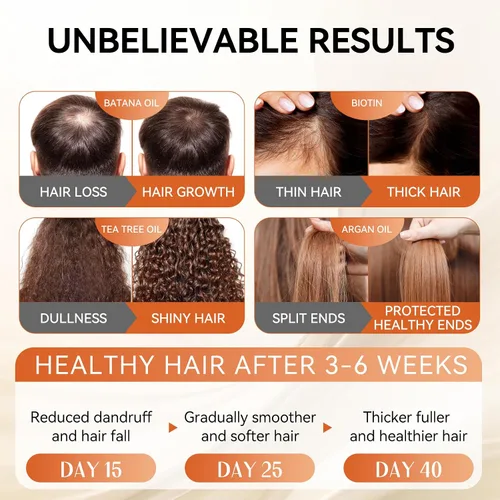 Vista 4 de Juego de champú y acondicionador de aceite de ricino para el crecimiento del cabello, fortalece y limpia el cabello fino, restauración del cabello