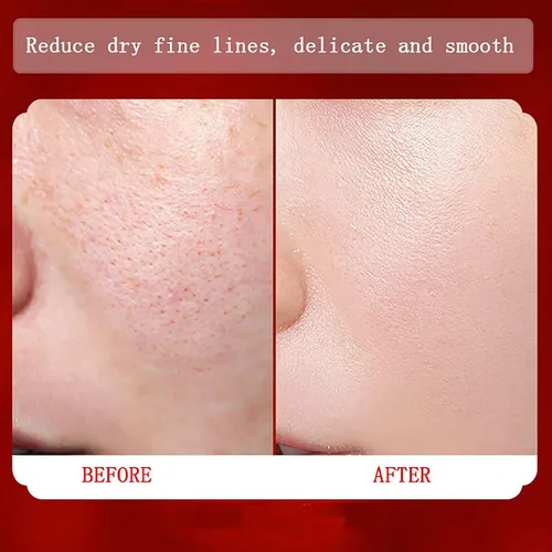 Vista 6 de Crema de sangre de dragón real de retinol, crema de sangre de dragón para mujeres, humectante facial de retinol, crema facial hidratante, crema