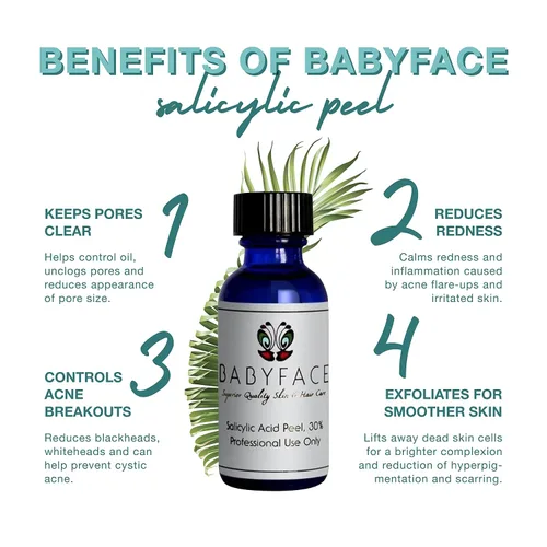Vista 2 de Babyface 30% ácido salicílico químico Peel – Beta hidroxiácido extra fuerte para acné, eliminación de puntos negros y exfoliación, sin alcohol, 1.2