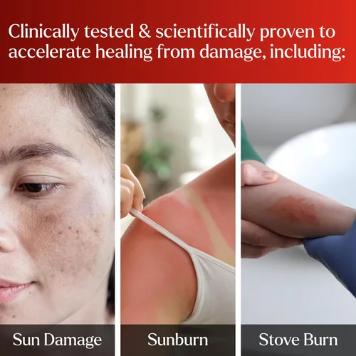 Vista 7 de PyratineXR Crème - Tratamiento antienvejecimiento y rosácea - Ultimate Cytokinin Skin Cream Reduce el enrojecimiento facial, lesiones de acné