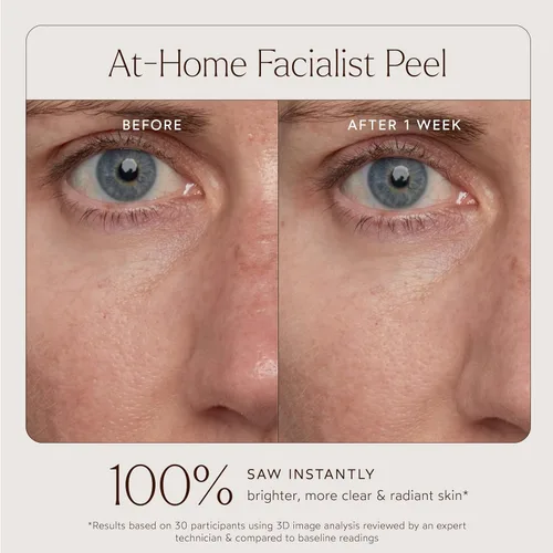 Vista 6 de True Botanicals At-Home - Mascarilla facial facial facial Tratamiento exfoliante natural para piel suave, radiante e hidratada