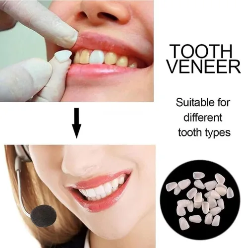 Vista 6 de Kits de reparación de dientes falsos para llenar los dientes rotos y huecos que faltan - Kits de reemplazo de dientes falsos y cuentas térmicas