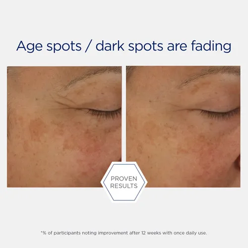 Vista 6 de NEOSTRATA Potent Retinol Complex Night Serum con 0,3% de retinol puro, ácido hialurónico. Sin fragancia, 1 fl oz