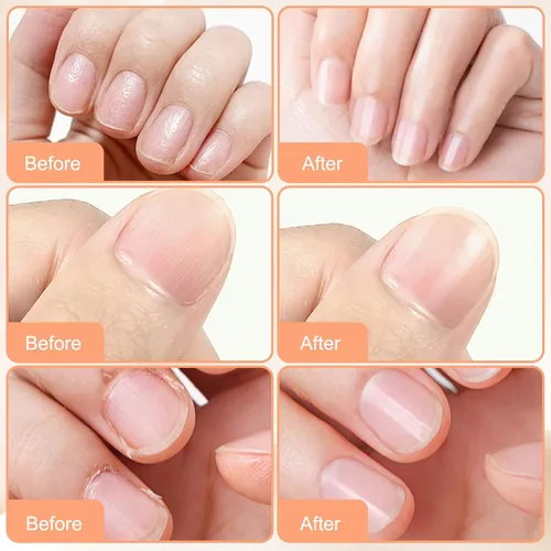 Vista 6 de Crema para el cuidado de uñas, reparación de uñas de los pies para dañados, fuerza y crecimiento de uñas, aceite de árbol de té, aceite de orégano