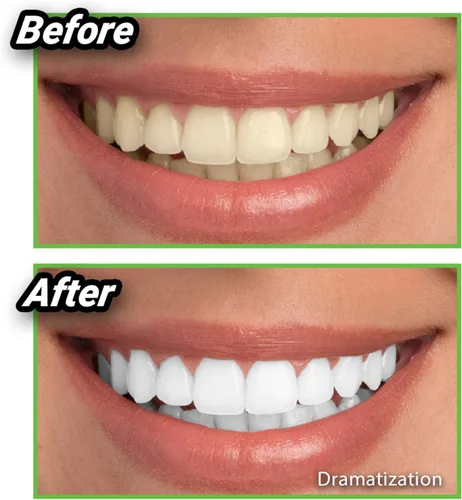 Vista 4 de Ontel Miracle Teeth Whitener - Polvo de carbón de coco blanqueador natural, como se ve en la televisión