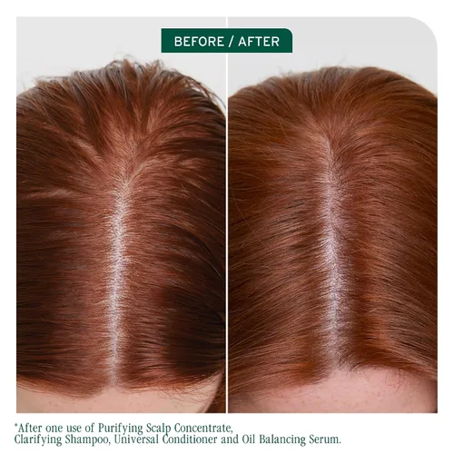 Vista 2 de Biolage Scalp Sync Clarifying Shampoo - Residue & Buildup Remover, For Oily Scalp