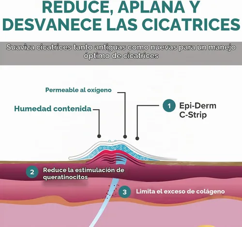 Vista 4 de Epiderm - Tiras de silicona para cicatrices, cinta de silicona reutilizable Transparente (paquete de 5)