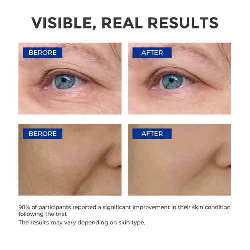 Vista 3 de Suero de retinol para cara, suero antienvejecimiento, colágeno retinoide con vitamina E rejuvenecimiento facial de líneas finas rápidas, iluminador