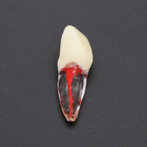 Vista 5 de 8pcs dientes modelo endodoncia endodoncia archivo RCT práctica pulpa para enseñanza estudio
