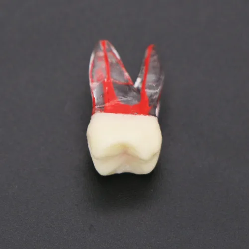 Vista 5 de 10 unids dientes modelo endodoncia archivo práctica pulpa para enseñanza estudio M807 16 #