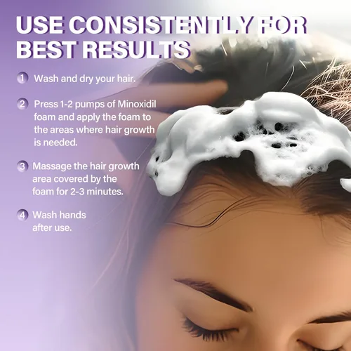 Vista 4 de 5% de espuma de minoxidil para mujer, espuma para el crecimiento del cabello, adecuada para adelgazamiento del cabello, retroceso de la línea