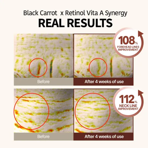 Vista 3 de GOODAL Black Carrot Vita-A Crema de ojos con retinol, crema diaria debajo de los ojos, cuidado de la piel suavizante e hidratante, K-Beauty, cuidado