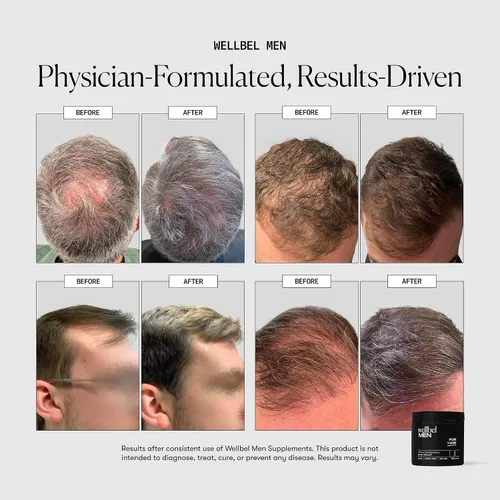 Vista 2 de WELLBEL Suplemento limpio para hombres, para cabello, piel y uñas, vegano, sin gluten y sin OMG, 90 unidades, paquete de 3