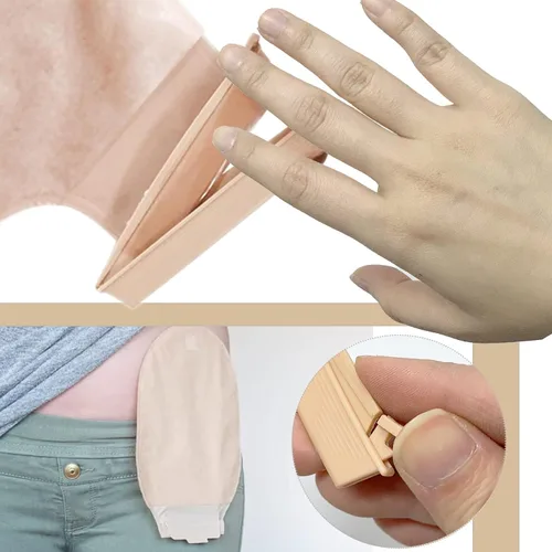 Vista 4 de Clip universal para bolsa de ostomía, abrazaderas de bolsa drenables, cierre de cola Surefit, grado médico (10 piezas)