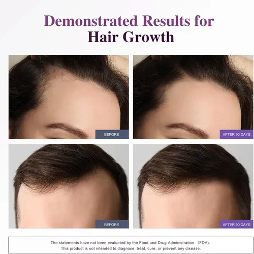 Vista 6 de Biotin 10,000MCG - Apoyo para el crecimiento del cabello para mujeres y hombres con colágeno y queratina, vitaminas para el cabello, la piel