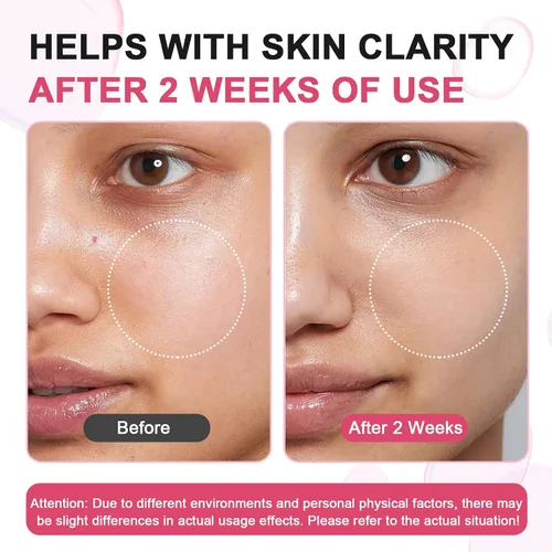 Vista 4 de TXA + niacinamida 15% (1.76 fl oz) Suero facial brillante, ácido hialurónico, ácido tranexámico, vitamina B12, suero facial para tono de piel