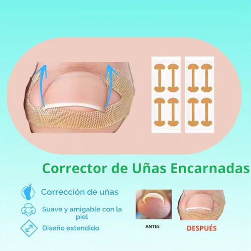 Vista 3 de Juego de corrector de uñas encarnadas con parche de corrección de uñas curvas, kit de eliminación de uñas mejorado, herramientas de pedicura