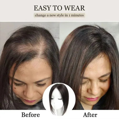 Vista 5 de Aimeolyn Toppers de cabello para mujer, cabello humano real, sin flequillo, extensiones de cabello superior para adelgazar, base de encaje Haisr