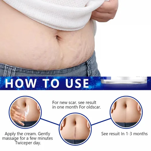 Vista 4 de Gel avanzado para cicatrices quirúrgicas, cara, cuerpo, piernas, quemaduras, acné, cesárea, estrías, queloides, eliminación eficaz de cicatrices