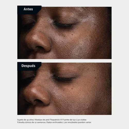 Vista 6 de Revision Skincare D·E·J Daily Boosting Serum™, suero antienvejecimiento, reduce las arrugas, apoya la firmeza de la piel y la elasticidad de la piel