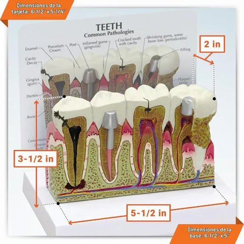 Vista 6 de GPI Anatomicals Modelo de anatomía de dientes humanos con problemas