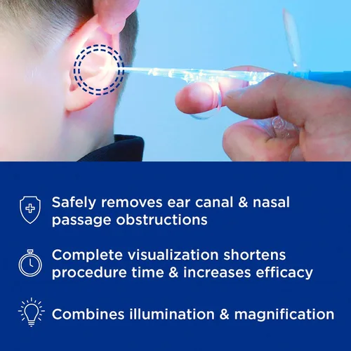 Vista 4 de Bionix - Cureta articulada iluminada para oídos, herramienta de eliminación de cerumen, ayuda a eliminar el exceso de cera y objetos extraños