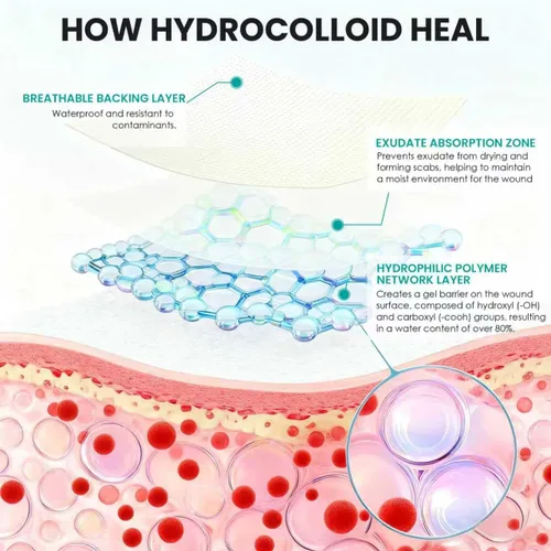 Vista 5 de Rollo hidrocoloide para el cuidado de heridas, vendajes hidrocoloides de grado médico, apósito de parche autoadhesivo cortado a medida, cinta