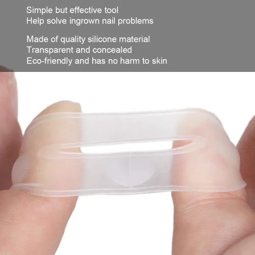 Vista 4 de Corrector de uñas encarnadas, 2 piezas de herramienta de corrección de uñas encarnadas de silicona, corrector de uñas encarnadas, tratamiento