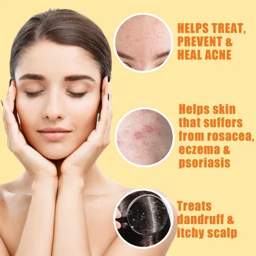 Vista 2 de Barra limpiadora de jabón de azufre 10% para cara y cuerpo, limpiador facial natural para el acné, piel grasa, mezcla curativa de citronela, aceite