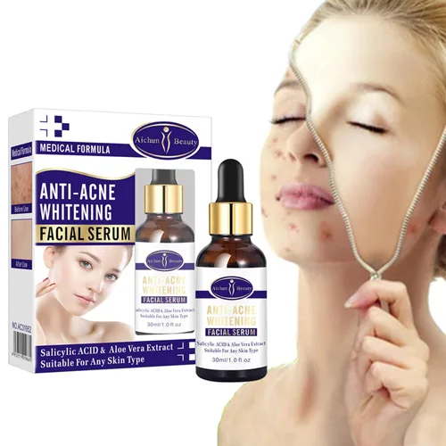 Vista 8 de AICHUN BEAUTY El ácido salicílico del extracto del aloe vera del suero facial anti-acné repara la piel dañada 1.0 fl oz