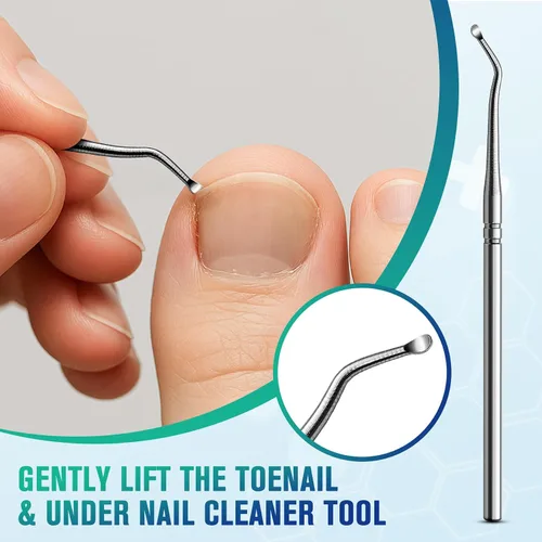 Vista 6 de FERYES Juego de corrector de uñas encarnadas, herramienta profesional de pedicura, 40 tiras alisadoras de uñas encarnadas sin dolor, 50 parches