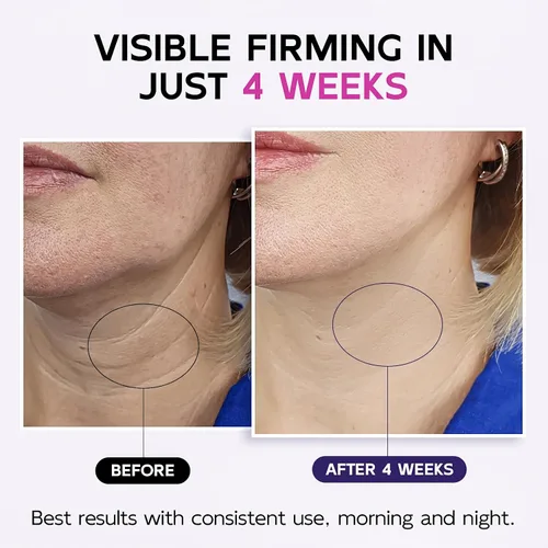 Vista 3 de Crema reafirmante para el cuello con retinol, AH-8 Hexapéptido Colágeno, reafirma la piel flácida en el cuello y escote, promueve la reparación